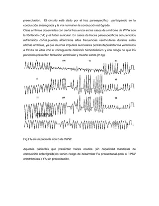 preexcitación.   El circuito está dado por el haz paraespecífico      participando en la
conducción anterógrada y la vía normal en la conducción retrógrada
Otras arritmias observadas con cierta frecuencia en los casos de síndrome de WPW son
la fibrilación (FA) y el flutter auricular. En casos de haces paraespecíficos con períodos
refractarios cortos,pueden alcanzarse altas frecuencias ventriculares durante estas
últimas arritmias, ya que muchos impulsos auriculares podrán depolarizar los ventrículos
a través de ellos con el consiguiente deterioro hemodinámico y con riesgo de que los
pacientes presenten fibrilación ventricular y muerte súbita.(V.fig)




Fig.FA en un paciente con S.de WPW.


Aquellos pacientes que presentan haces ocultos (sin capacidad manifiesta de
conducción anterógrada)no tienen riesgo de desarrollar FA preexcitadas,pero si TPSV
ortodrómicas o FA sin preexcitación.
 