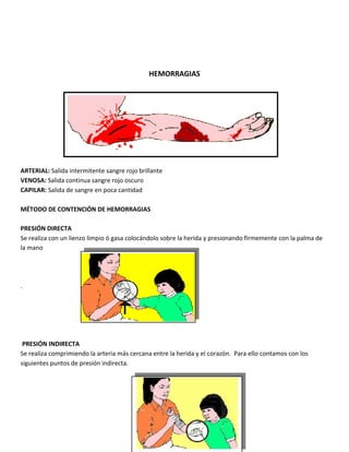 HEMORRAGIAS
ARTERIAL: Salida intermitente sangre rojo brillante
VENOSA: Salida continua sangre rojo oscuro
CAPILAR: Salida de sangre en poca cantidad
MÉTODO DE CONTENCIÓN DE HEMORRAGIAS
PRESIÓN DIRECTA
Se realiza con un lienzo limpio ó gasa colocándolo sobre la herida y presionando firmemente con la palma de
la mano
.
PRESIÓN INDIRECTA
Se realiza comprimiendo la arteria más cercana entre la herida y el corazón. Para ello contamos con los
siguientes puntos de presión indirecta.
 