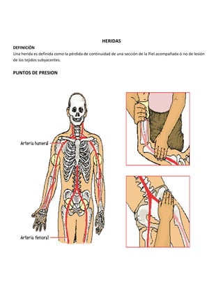 HERIDAS
DEFINICIÓN
Una herida es definida como la pérdida de continuidad de una sección de la Piel acompañada ó no de lesión
de los tejidos subyacentes.
PUNTOS DE PRESION
 