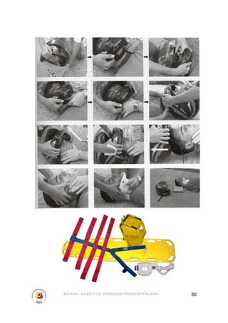 MANUAL BASICO DE ATENCION PREHOSPITALARIA   60
 