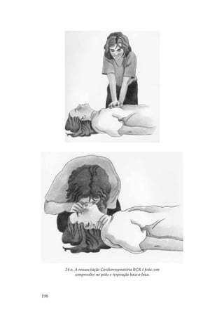 24-a, A ressuscitação Cardiorrespiratória RCR é feita com
            compressões no peito e respiração boca-a-boca.




198
 