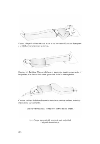 Eleve a cabeça da vítima cerca de 30 cm se ela não tiver dificuldade de respirar
e se não houver ferimentos na cabeça.




Eleve os pés da vítima 30 cm se não houver ferimentos na cabeça, nas costas e
no pescoço, e se ela não tiver ossos quebrados na bacia ou nas pernas.




Coloque a vítima de lado se houver ferimentos no rosto ou na boca, se estiver
inconsciente ou vomitando.


          Deixe a vítima deitada se não tiver certeza de seu estado.




              24-c, Coloque a pessoa ferida na posição mais confortável
                             e adequada à sua situação.




204
 