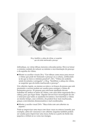 24-g, Imobilize a cabeça da vítima, se suspeitar
                      que ela tenha machucado o pescoço.



dobradiças, ou várias tábuas menores colocadas juntas. Deve-se tomar
o extremo cuidado de reduzir ao mínimo a movimentação do pescoço
e da espinha da vítima.
 Mostre os auxílios visuais 24-e, “Use tábuas como maca para mover
 a vítima que pode ter fraturado o pescoço ou a coluna, certificando-
 se de que se mova o mínimo possível”; 24-f, “Vítima de acidente
 sendo levantada e carregada”; e 24-g, “Imobilize a cabeça da vítima,
 se suspeitar que ela tenha machucado o pescoço”.
Um cobertor, tapete, ou mesmo as mãos e os braços da pessoa que está
prestando o socorro podem ser usados para carregar a vítima de
ferimentos graves. As pessoas que estiverem ajudando devem
trabalhar de ambos os lados da vítima, com uma delas segurando-lhe a
cabeça, para que fique firme. Alguém deverá ficar encarregado de dar
o sinal para que todos os ajudantes levantem e movimentem a vítima
ao mesmo tempo, caso contrário, ela poderá ficar mais machucada,
graças a movimentos desnecessários e mal coordenados.
 Mostre o auxílio visual 24-h: “Maca feita com um cobertor ou
 jaqueta”.
Pode-se improvisar uma maca com duas varas ou estacas (usando, por
exemplo, cabos de vassoura) e um cobertor. Jaquetas também podem
ser usadas para improvisar uma maca; fecha-se a parte da frente das
jaquetas e enfiam-se as varas nas mangas.

                                                                   211
 