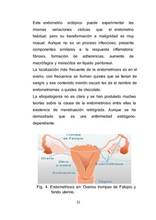 11
Este endometrio ectópico puede experimentar las
mismas variaciones cíclicas que el endometrio
habitual, pero su transformación a malignidad es muy
inusual. Aunque no es un proceso infeccioso, presenta
componentes similares a la respuesta inflamatoria:
fibrosis, formación de adherencias, aumento de
macrófagos y monocitos en líquido peritoneal.
La localización más frecuente de la endometriosis es en el
ovario; con frecuencia se forman quistes que se llenan de
sangre y ese contenido marrón oscuro les da el nombre de
endometriomas o quistes de chocolate.
La etiopatogenia no es clara y se han postulado muchas
teorías sobre la causa de la endometriosis entre ellas la
existencia de menstruación retrógrada. Aunque se ha
demostrado que es una enfermedad estrógeno-
dependiente.
Fig. 4. Endometriosis en: Ovarios trompas de Falopio y
fondo uterino.
 