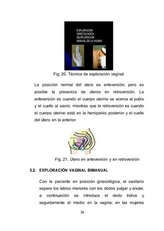 36
Fig. 20. Técnica de exploración vaginal
La posición normal del útero es anteversión, pero es
posible la presencia de úteros en retroversión. La
anteversión es cuando el cuerpo uterino se acerca al pubis
y el cuello al sacro; mientras que la retroversión es cuando
el cuerpo uterino está en la hemipelvis posterior y el cuello
del útero en la anterior.
Fig. 21. Útero en anteversión y en retroversión
3.2. EXPLORACIÓN VAGINAL BIMANUAL
Con la paciente en posición ginecológica, el sanitario
separa los labios menores con los dedos pulgar y anular,
a continuación se introduce el dedo índice y
seguidamente el medio en la vagina; en las mujeres
 