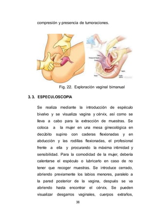 38
compresión y presencia de tumoraciones.
Fig. 22. Exploración vaginal bimanual
3. 3. ESPECULOSCOPIA
Se realiza mediante la introducción de espéculo
bivalvo y se visualiza vagina y cérvix, así como se
lleva a cabo para la extracción de muestras. Se
coloca a la mujer en una mesa ginecológica en
decúbito supino con caderas flexionadas y en
abducción y las rodillas flexionadas, el profesional
frente a ella y procurando la máxima intimidad y
sensibilidad. Para la comodidad de la mujer, debería
calentarse el espéculo o lubricarlo en caso de no
tener que recoger muestras. Se introduce cerrado,
abriendo previamente los labios menores, paralelo a
la pared posterior de la vagina, después se va
abriendo hasta encontrar el cérvix. Se pueden
visualizar desgarros vaginales, cuerpos extraños,
 