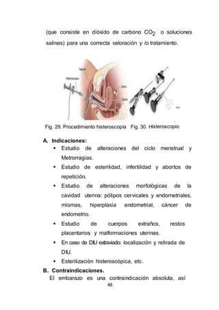 48
(que consiste en dióxido de carbono CO2 o soluciones
salinas) para una correcta valoración y /o tratamiento.
Fig. 29. Procedimiento histeroscopía Fig. 30. Histeroscopio
A. Indicaciones:
 Estudio de alteraciones del ciclo menstrual y
Metrorragias.
 Estudio de esterilidad, infertilidad y abortos de
repetición.
 Estudio de alteraciones morfológicas de la
cavidad uterina: pólipos cervicales y endometriales,
miomas, hiperplasia endometrial, cáncer de
endometrio.
 Estudio de cuerpos extraños, restos
placentarios y malformaciones uterinas.
 En caso de DIU extraviado: localización y retirada de
DIU.
 Esterilización histeroscópica, etc.
B. Contraindicaciones.
El embarazo es una contraindicación absoluta, así
 