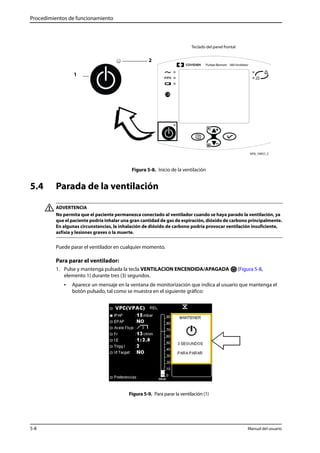 Procedimientos de funcionamiento 
Teclado del panel frontal 
2 
Figura 5-8. Inicio de la ventilación 
1 
5.4 Parada de la ventilación 
ADVERTENCIA 
No permita que el paciente permanezca conectado al ventilador cuando se haya parado la ventilación, ya 
que el paciente podría inhalar una gran cantidad de gas de espiración, dióxido de carbono principalmente. 
En algunas circunstancias, la inhalación de dióxido de carbono podría provocar ventilación insuficiente, 
asfixia y lesiones graves o la muerte. 
Puede parar el ventilador en cualquier momento. 
Para parar el ventilador: 
1. Pulse y mantenga pulsada la tecla VENTILACION ENCENDIDA/APAGADA (Figura 5-8, 
elemento 1) durante tres (3) segundos. 
• Aparece un mensaje en la ventana de monitorización que indica al usuario que mantenga el 
botón pulsado, tal como se muestra en el siguiente gráfico: 
Figura 5-9. Para parar la ventilación (1) 
5-8 Manual del usuario 
 