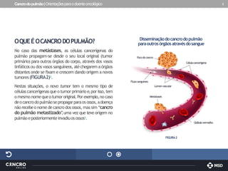 Cancrodopulmão|Orientaçõesparaodoenteoncológico 5
OQUEÉOCANCRODOPULMÃO?
No caso das metástases, as células cancerígenas do
pulmão propagam-se desde o seu local original (tumor
primário) para outros órgãos do corpo, através dos vasos
linfáticos ou dos vasos sanguíneos, atéchegarem a órgãos
distantes onde se fixam e crescem dando origem a novos
tumores(FIGURA2)3.
Nestas situações, o novo tumor tem o mesmo tipo de
célulascancerígenas queo tumor primárioe,por isso,tem
omesmonomequeotumororiginal.Porexemplo,nocaso
deocancrodopulmãosepropagarparaosossos,adoença
nãorecebeonome decancrodos ossos,mas sim “cancro
do pulmão metastizado”
,uma vez que teve origem no
pulmãoeposteriormenteinvadiuos ossos3.
FIGURA2
Disseminaçãodocancrodopulmão
paraoutrosórgãosatravésdosangue
Fluxosanguíneo
Glóbulovermelho
Célulacancerígena
Lúmenvascular
Focodocancro
Metástases
 