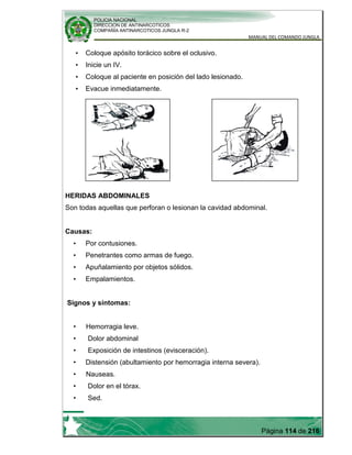 POLICIA NACIONAL
DIRECCION DE ANTINARCOTICOS
COMPAÑÍA ANTINARCOTICOS JUNGLA R-2
MANUAL DEL COMANDO JUNGLA
Página 114 de 216
• Coloque apósito torácico sobre el oclusivo.
• Inicie un IV.
• Coloque al paciente en posición del lado lesionado.
• Evacue inmediatamente.
HERIDAS ABDOMINALES
Son todas aquellas que perforan o lesionan la cavidad abdominal.
Causas:
• Por contusiones.
• Penetrantes como armas de fuego.
• Apuñalamiento por objetos sólidos.
• Empalamientos.
Signos y síntomas:
• Hemorragia leve.
• Dolor abdominal
• Exposición de intestinos (evisceración).
• Distensión (abultamiento por hemorragia interna severa).
• Nauseas.
• Dolor en el tórax.
• Sed.
 