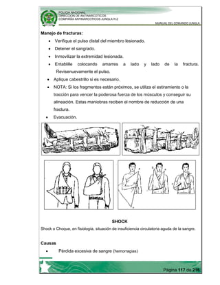POLICIA NACIONAL
DIRECCION DE ANTINARCOTICOS
COMPAÑÍA ANTINARCOTICOS JUNGLA R-2
MANUAL DEL COMANDO JUNGLA
Página 117 de 216
Manejo de fracturas:
Verifique el pulso distal del miembro lesionado.
Detener el sangrado.
Inmovilizar la extremidad lesionada.
Entablille colocando amarres a lado y lado de la fractura.
Revisenuevamente el pulso.
Aplique cabestrillo si es necesario.
NOTA: Si los fragmentos están próximos, se utiliza el estiramiento o la
tracción para vencer la poderosa fuerza de los músculos y conseguir su
alineación. Estas maniobras reciben el nombre de reducción de una
fractura.
Evacuación.
SHOCK
Shock o Choque, en fisiología, situación de insuficiencia circulatoria aguda de la sangre.
Causas
Pérdida excesiva de sangre (hemorragias)
 