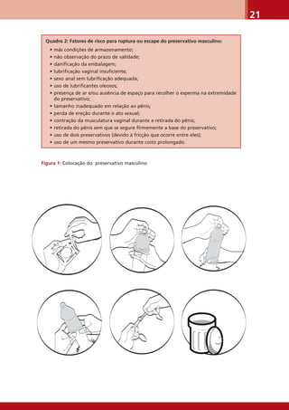 21
Quadro 2: Fatores de risco para ruptura ou escape do preservativo masculino:
• más condições de armazenamento;
• não observação do prazo de validade;
• daniﬁcação da embalagem;
• lubriﬁcação vaginal insuﬁciente;
• sexo anal sem lubriﬁcação adequada;
• uso de lubriﬁcantes oleosos;
• presença de ar e/ou ausência de espaço para recolher o esperma na extremidade
do preservativo;
• tamanho inadequado em relação ao pênis;
• perda de ereção durante o ato sexual;
• contração da musculatura vaginal durante a retirada do pênis;
• retirada do pênis sem que se segure ﬁrmemente a base do preservativo;
• uso de dois preservativos (devido à fricção que ocorre entre eles);
• uso de um mesmo preservativo durante coito prolongado.
Figura 1: Colocação do preservativo masculino
 