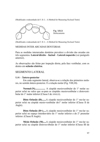 97
(Modificado e redesenhado de F. D. I. - A Method for Measuring Occlusal Traits)
Fig. VIII,9
Deslocamento
(Modificado e redesenhado de F. D. I. - A Method for Measuring Occlusal Traits)
MEDIDAS INTER ARCADAS DENTÁRIAS
Para as medidas interarcadas dentárias prevalece a divisão das arcadas em
três segmentos. Lateral direito – Incisal – Lateral esquerdo (ver parágrafo
anterior)..
As observações são feitas por inspeção direta, pela face vestibular, com os
dentes em oclusão cêntrica.
SEGMENTO LATERAL
8,46 – Ântero-posterior
Em cada segmento lateral, observa-se a relação dos primeiros mola-
res, no sentido ântero-posterior. É a relação molar (Fig. VIII,10).
Normal (N)................. A cúspide mesiovestibular do 1° molar su-
perior oclui no sulco que se-para as cúspides mesiovestibular e distovesti-
bular do 1° malar inferior (Classe I de ANGLE).
Disto Oclusão (D).......A cúspide mesiovestibular do 1° mo-lar su-
perior oclui na cúspide mesio-vestibular do1° molar inferior (Classe II de
Angle).
Disto Oclusão (D+).....A cúspide mesiovestibular do 1° mo-lar su-
perior oclui no espaço interden-tário do 1° molar inferior e do 2° premolar
inferior. (Classe II Angle).
Mésio Oclusão (M).....A cúspide mesiovestibular do 1° mo-lar su-
perior oclui na cúspide distoves-tibular do 1° molar inferior (Classe III de
 