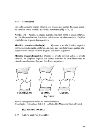 99
8,48 – Transversal
Em cada segmento lateral, observa-se a relação dos dentes da arcada dentá-
ria superior com a inferior, no sentido transversal (Fig. VIII,12).
Normal (N) Quando a arcada dentária superior cobre a arcada inferior.
As cúspides vestibulares dos dentes inferiores se localizam entre as cúspides
vestibulares e linguais dos superiores.
Mordida cruzada vestibular(V) Quando a arcada dentária superior
cobre exagerada-mente a inferior. As cúspi-des vestibulares dos dentes infe-
riores ocluem com as cúspides linguais dos dentes superiores.
Mordida cruzada lingual (L) Quando a arcada inferior cobre a arcada
superior. As cúspides linguais dos dentes inferiores se loca-lizam entre as
cúspides vestibulares e linguais dos dentes superiores.
Fig. VIII,12
Relação dos segmentos laterais no sentido transversal
(Modificado e redesenhado de F.D.I. – A Method for Measuring Occlusal Traits)
SEGMENTO INCISAL
8,49 – Ântero-posterior (Ressalte)
 