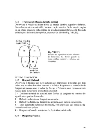 101
8,51 – Transversal (Desvio da linha média)
Observa-se a relação da linha média da arcada dentária superior e inferior.
Normalmente devem coincidir, na observação anterior. Se há desvio, regis-
tra-se o lado em que a linha média, da arcada dentária inferior, está desviada
em relação à linha média superior, esquerdo ou direito (Fig. VIII,15).
Fig. VIII,15
Relação dos segmentos incisais no senti-
do transversal. Há desvio quando as
linhas médias, superior e inferior, não
coincidem.
ESTUDO FISIOLÓGICO
8,52 – Desgaste Oclusal
Observa-se o desgaste das faces oclusais dos premolares e molares, dos dois
lados, nas arcadas dentárias superior e inferior. Registra-se a ocorrência de
desgaste de acordo com o índice de Davies e Pedersen, com pequena modi-
ficação para incluir uma última fase adicional.
0 – Contorno normal do esmalte, sem facetas de desgaste ou somente in-
significantes perdas de esmalte.
1 – Definitivas facetas de desgaste no esmalte.
2 – Definitivas facetas de desgaste no esmalte, com exposi-ção dentina.
3 – Mais adiantada exposição de dentina, com exposição das linhas de re-
cesso da cavidade pulpar.
4 – Desgaste até o colo anatômico do dente (fase adicional).
8,53 – Desgaste proximal
 