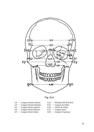 30
Fig. III,4
3,8 — Largura frontal mínima
3,9 — Largura frontal máxima
4,6 — Largura facial superior
4,8 — Largura facial máxima
4,9 — Largura facial média
4,10 — Distância BI JUGALE
4,25 — Largura da órbita
4,30 — Altura da órbita
4,31 — Largura nasal
4,46 — Largura bi goníaca
 