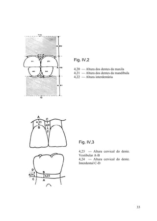 33
Fig. IV,2
4,20 — Altura dos dentes da maxila
4,21 — Altura dos dentes da mandíbula
4,22 — Altura interdentária
Fig. IV,3
4,23 — Altura cervical do dente.
Vestibular A-B
4,24 — Altura cervical do dente.
Interdental C-D
 