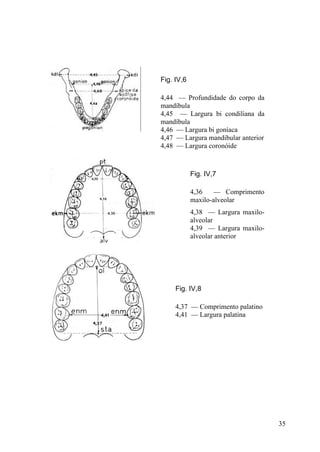 35
Fig. IV,6
4,44 — Profundidade do corpo da
mandíbula
4,45 — Largura bi condiliana da
mandíbula
4,46 — Largura bi goníaca
4,47 — Largura mandibular anterior
4,48 — Largura coronóide
Fig. IV,7
4,36 — Comprimento
maxilo-alveolar
4,38 — Largura maxilo-
alveolar
4,39 — Largura maxilo-
alveolar anterior
Fig. IV,8
4,37 — Comprimento palatino
4,41 — Largura palatina
 