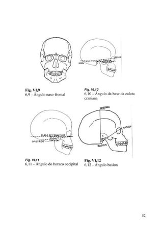 52
Fig. VI,9
6,9 – Ângulo naso-frontal
Fig. VI,10
6,10 – Ângulo da base da calota
craniana
Fig. VI,11
6,11 – Ângulo do buraco occipital
Fig. VI,12
6,12 – Ângulo basion
 