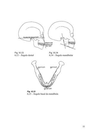 53
Fig. VI,13
6,13 – Ângulo dental
Fig. VI,14
6,14 – Ângulo mandibular
Fig. VI,15
6,15 – Ângulo basal da mandíbula
 