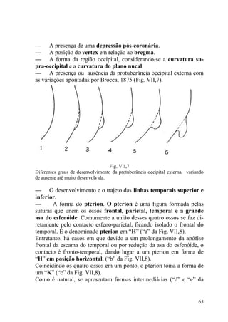 65
— A presença de uma depressão pós-coronária.
— A posição do vertex em relação ao bregma.
— A forma da região occipital, considerando-se a curvatura su-
pra-occipital e a curvatura do plano nucal.
— A presença ou ausência da protuberância occipital externa com
as variações apontadas por Brocca, 1875 (Fig. VII,7).
Fig. VII,7
Diferentes graus de desenvolvimento da protuberância occipital externa, variando
de ausente até muito desenvolvida.
— O desenvolvimento e o trajeto das linhas temporais superior e
inferior.
— A forma do pterion. O pterion é uma figura formada pelas
suturas que unem os ossos frontal, parietal, temporal e a grande
asa do esfenóide. Comumente a união desses quatro ossos se faz di-
retamente pelo contacto esfeno-parietal, ficando isolado o frontal do
temporal. É o denominado pterion em “H” (“a” da Fig. VII,8).
Entretanto, há casos em que devido a um prolongamento da apófise
frontal da escama do temporal ou por redução da asa do esfenóide, o
contacto é fronto-temporal, dando lugar a um pterion em forma de
“H” em posição horizontal. (“b” da Fig. VII,8).
Coincidindo os quatro ossos em um ponto, o pterion toma a forma de
um “K” (“c” da Fig. VII,8).
Como é natural, se apresentam formas intermediárias (“d” e “e” da
 