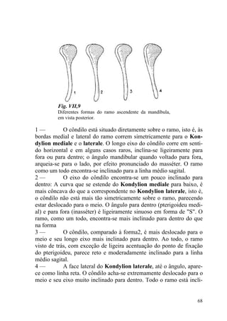 68
Fig. VII,9
Diferentes formas do ramo ascendente da mandíbula,
em vista posterior.
1 — O côndilo está situado diretamente sobre o ramo, isto é, às
bordas medial e lateral do ramo correm simetricamente para o Kon-
dylion mediale e o laterale. O longo eixo do côndilo corre em senti-
do horizontal e em alguns casos raros, inclina-se ligeiramente para
fora ou para dentro; o ângulo mandibular quando voltado para fora,
arqueia-se para o lado, por efeito pronunciado do masséter. O ramo
como um todo encontra-se inclinado para a linha médio sagital.
2 — O eixo do côndilo encontra-se um pouco inclinado para
dentro: A curva que se estende do Kondylion mediale para baixo, é
mais côncava do que a correspondente no Kondylion laterale, isto é,
o côndilo não está mais tão simetricamente sobre o ramo, parecendo
estar deslocado para o meio. O ângulo para dentro (pterigoideu medi-
al) e para fora (inasséter) é ligeiramente sinuoso em forma de "S". O
ramo, como um todo, encontra-se mais inclinado para dentro do que
na forma
3 — O côndilo, comparado à forma2, é mais deslocado para o
meio e seu longo eixo mais inclinado para dentro. Ao todo, o ramo
visto de trás, com exceção de ligeira acentuação do ponto de fixação
do pterigoideu, parece reto e moderadamente inclinado para a linha
médio sagital.
4 — A face lateral do Kondylion laterale, até o ângulo, apare-
ce como linha reta. O côndilo acha-se extremamente deslocado para o
meio e seu eixo muito inclinado para dentro. Todo o ramo está incli-
 