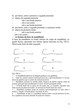 73
b) por baixo, entre o primeiro e segundo premolar
c) abaixo do segundo premolar
- sob a sua borda anterior
- sob o seu centro
- sob a sua borda posterior
d) por baixo, entre o segundo premolar e o primeiro molar.
e) abaixo do primeiro molar
- sob a sua borda anterior
- sob o seu centro
— As formas da base da mandíbula:
A base da mandíbula ou bordo inferior do corpo da mandíbula, se-
gundo Keiter, apresenta seis formas típicas descritas na Fig. VII,11.
Observação feita do lado esquerdo.
Fig. VII,11
1 — A mandíbula apoia-se no ângulo goníaco e no gnathion.
2 — Ponto de contacto anterior deslocado para trás a aproximadamente 1/3 da dis-
tância do gnathion que é o ponto de contacto posterior.
3 — Mandíbula oscilante no sentido amplo, fraqueza da apófise angular, ponto de
contacto principal aproximadamente no meio, incisura preangular nítida.
4 — O bordo basal não se apoia em um ponto mas, ao contrário, seguindo uma
linha extensa do plano horizontal. As incisuras do bordo basal são curtas.
5 — Mandíbula oscilante; ponto de contacto aproximadamente no meio entre o
mento e o ângulo. O bordo basal é em forma de arco.
6 — Semelhante ao tipo 5; a mandíbula repousa sobre a secção posterior do bor-
do; o gnathion está muito afastado do ponto de contacto.
 