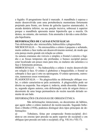 79
e fugidio. O prognatismo facial é marcado. A mandíbula é espessa e
muito desenvolvida com uma protuberância mentoniana fortemente
projetada para frente, em forma de galocha (queixo atamancado). A
arcada dentária inferior, na sua porção incisiva, sobressai à superior
porque a mandíbula apresenta maior hipertrofia que a maxila. Os
dentes, no entanto, são normais. Esta anomalia é devida a uma disfun-
ção hipofisária.
DEFORMAÇÕES DE CAUSAS ENCEFÁLICAS
Tais deformações são: microcefalia, hidrocefalia e plagiocefalia.
MICROCEFALIA — Na microcefalia o crânio é pequeno e achatado,
muito embora a face tenha um desenvolvimento normal, de modo que
esta pareça muito grande em relação ao crânio.
As suturas cranianas são visíveis e simples; o frontal é estreito e fugi-
dio e as fossas temporais são profundas; o buraco occipital parece
estar localizado um pouco mais para trás; os malares são salientes e a
face é fortemente protrusa.
HIDROCEFALIA — Na hidrocefalia o crânio é muito desenvolvido
em relação à face. O crânio é globuloso e braquicéfalo; o frontal se
sobrepõe à face que é orto ou opistognata. O crânio apresenta, outros-
sim, numerosos ossos wormianos.
PLAGIOCEFALIA — Na plagiocefalia ou deformação oblíquo ova-
lar, o crânio caracteriza-se pela assimetria. A plagiocefalia pode ser
direita ou esquerda. Sua origem é, todavia, ainda discutida. Entretan-
to, segundo alguns autores, esta deformação seria de origem étnica e
decorrente de uma longa permanência do recém nascido deitado so-
mente de um lado.
DEFORMAÇÕES CRANIANAS DE ORIGEM ÉTNICA
São deformações intencionais, ou decorrentes de hábitos,
que agem sobre o crânio maleável do recém-nascido. Segundo Imbe-
lloni e Dimbo (1938), podemos distinguir dois tipos principais de de-
formações:
a) Tobulares, feitas por compressão fronto-occipital; divi-
dem-se em erectas (por pressão na parte superior do occipital) e em
oblíquas (por pressão em todo o occipital). (Fig. VII.16 e VII.17).
 