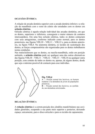 85
OCLUSÃO CÊNTRICA
A relação da arcada dentária superior com a arcada dentária inferior e a rela-
ção da mandíbula com o resto do crânio são estudadas com os dentes em
oclusão cêntrica.
Oclusão cêntrica é aquela relação individual das arcadas dentárias, em que
os dentes, superiores e inferiores, conseguem o maior número de contatos
intercuspídeos. Em uma boa oclusão cêntrica, todos os dentes contactam
com seus antagonistas, conforme indicado como normal, para os dentes
posteriores, nas figuras VIII,10 – VIII,11 – VIII,12 e, para os dentes anterio-
res, na figura VIII,4. Na anatomia dentária, os tecidos de sustentação dos
dentes, as forças compensatórias são organizadas para os dentes trabalharem
nestas condições.
Nas maloclusõesem que os dentes, ou maxila-mandíbula, estão em posição
anômala, a oclusão cêntrica pode ser qualquer uma das outras alternativas
das figuras VIII,10 – VIII,11 – VIII,12 – VIII,13 – VIII,14 ou qualquer outra
posição, com contato de todos os dentes ou, apenas, de alguns dentes, desde
que seja o máximo possível de contacto para esse indivíduo.
Fig. VIII,4
A — Posição normal dos Incisivos, no homem
moderno e na dentadura de jovem de populações
primitivas.
B — Posição normal dos Incisivos, na senilida-
de, nas dentaduras atricionadas.
RELAÇÃO CÊNTRICA
A relação cêntrica é a correta posição dos côndilos mandi-bulares nas cavi-
dades glenóides, ocupando a sua parte mais superior e posterior, deixando
espaço, unicamente, para o disco articular e para os tecidos de capeamento.
 