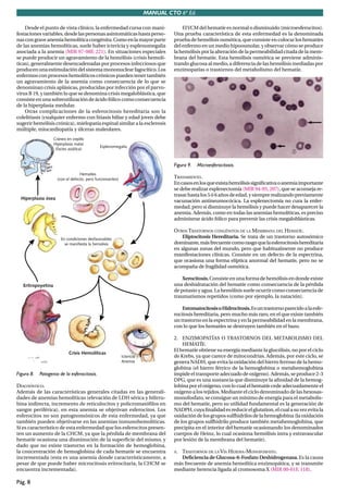 MANUAL CTO 6ª Ed.

    Desde el punto de vista clínico, la enfermedad cursa con mani-           El VCM del hematíe es normal o disminuido (microesferocitos).
festaciones variables, desde las personas asintomáticas hasta perso-     Una prueba característica de esta enfermedad es la denominada
nas con grave anemia hemolítica congénita. Como en la mayor parte        prueba de hemólisis osmótica, que consiste en colocar los hematíes
de las anemias hemolíticas, suele haber ictericia y esplenomegalia       del enfermo en un medio hipoosmolar, y observar cómo se produce
asociada a la anemia (MIR 97-98F, 221). En situaciones especiales        la hemólisis por la alteración de la permeabilidad citada de la mem-
se puede producir un agravamiento de la hemólisis (crisis hemolí-        brana del hematíe. Esta hemólisis osmótica se previene adminis-
ticas), generalmente desencadenadas por procesos infecciosos que         trando glucosa al medio, a diferencia de las hemólisis mediadas por
producen una estimulación del sistema mononuclear fagocítico. Los        enzimopatías o trastornos del metabolismo del hematíe.
enfermos con procesos hemolíticos crónicos pueden tener también
un agravamiento de la anemia como consecuencia de lo que se
denominan crisis aplásicas, producidas por infección por el parvo-
virus B 19, y también lo que se denomina crisis megaloblástica, que
consiste en una sobreutilización de ácido fólico como consecuencia
de la hiperplasia medular.
    Otras complicaciones de la esferocitosis hereditaria son la
colelitiasis (cualquier enfermo con litiasis biliar y edad joven debe
sugerir hemólisis crónica), mielopatía espinal similar a la esclerosis
múltiple, miocardiopatía y úlceras maleolares.




                                                                         Figura 9.   Microesferocitosis.

                                                                         TRATAMIENTO.
                                                                         En casos en los que exista hemólisis signiﬁcativa o anemia importante
                                                                         se debe realizar esplenectomía (MIR 94-95, 207), que se aconseja re-
                                                                         trasar hasta los 5 ó 6 años de edad, y siempre realizando previamente
                                                                         vacunación antineumocócica. La esplenectomía no cura la enfer-
                                                                         medad, pero sí disminuye la hemólisis y puede hacer desaparecer la
                                                                         anemia. Además, como en todas las anemias hemolíticas, es preciso
                                                                         administrar ácido fólico para prevenir las crisis megaloblásticas.

                                                                         OTROS TRASTORNOS CONGÉNITOS DE LA MEMBRANA DEL HEMATÍE.
                                                                            Eliptocitosis Hereditaria. Se trata de un trastorno autosómico
                                                                         dominante, más frecuente como rasgo que la esferocitosis hereditaria
                                                                         en algunas zonas del mundo, pero que habitualmente no produce
                                                                         manifestaciones clínicas. Consiste en un defecto de la espectrina,
                                                                         que ocasiona una forma elíptica anormal del hematíe, pero no se
                                                                         acompaña de fragilidad osmótica.

                                                                             Xerocitosis. Consiste en una forma de hemólisis en donde existe
                                                                         una deshidratación del hematíe como consecuencia de la pérdida
                                                                         de potasio y agua. La hemólisis suele ocurrir como consecuencia de
                                                                         traumatismos repetidos (como por ejemplo, la natación).

                                                                             Estomatocitosis o Hidrocitosis. Es un trastorno parecido a la esfe-
                                                                         rocitosis hereditaria, pero mucho más raro, en el que existe también
                                                                         un trastorno en la espectrina y en la permeabilidad en la membrana,
                                                                         con lo que los hematíes se destruyen también en el bazo.

                                                                         2. ENZIMOPATÍAS O TRASTORNOS DEL METABOLISMO DEL
                                                                             HEMATÍE.
                                                                         El hematíe obtiene su energía mediante la glucólisis, no por el ciclo
                                                                         de Krebs, ya que carece de mitocondrias. Además, por este ciclo, se
                                                                         genera NADH, que evita la oxidación del hierro ferroso de la hemo-
                                                                         globina (el hierro férrico de la hemoglobina o metahemoglobina
Figura 8.   Patogenia de la esferocitosis.                               impide el transporte adecuado de oxígeno). Además, se produce 2-3
                                                                         DPG, que es una sustancia que disminuye la aﬁnidad de la hemog-
DIAGNÓSTICO.                                                             lobina por el oxígeno, con lo cual el hematíe cede adecuadamente el
Además de las características generales citadas en las generali-         oxígeno a los tejidos. Mediante el ciclo denominado de las hexosas-
dades de anemias hemolíticas (elevación de LDH sérica y bilirru-         monofosfato, se consigue un mínimo de energía para el metabolis-
bina indirecta, incremento de reticulocitos y policromatóﬁlos en         mo del hematíe, pero su utilidad fundamental es la generación de
sangre periférica), en esta anemia se objetivan esferocitos. Los         NADPH, cuya ﬁnalidad es reducir el glutation, el cual a su vez evita la
esferocitos no son patognomónicos de esta enfermedad, ya que             oxidación de los grupos sulfhidrilos de la hemoglobina (la oxidación
también pueden objetivarse en las anemias inmunohemolíticas.             de los grupos sulfhidrilo produce también metahemoglobina, que
Sí es característico de esta enfermedad que los esferocitos presen-      precipita en el interior del hematíe ocasionando los denominados
ten un aumento de la CHCM, ya que la pérdida de membrana del             cuerpos de Heinz, lo cual ocasiona hemólisis intra y extravascular
hematíe ocasiona una disminución de la superﬁcie del mismo, y            por lesión de la membrana del hematíe).
dado que no existe trastorno en la formación de hemoglobina,
la concentración de hemoglobina de cada hematíe se encuentra             A.TRASTORNOS DE LA VÍA HEXOSA-MONOFOSFATO.
incrementada (esta es una anemia donde característicamente, a              Deﬁciencia de Glucosa-6-Fosfato Deshidrogenasa. Es la causa
pesar de que puede haber microcitosis eritrocitaria, la CHCM se          más frecuente de anemia hemolítica enzimopática, y se transmite
encuentra incrementada).                                                 mediante herencia ligada al cromosoma X (MIR 00-01F, 118).

Pág. 8
 