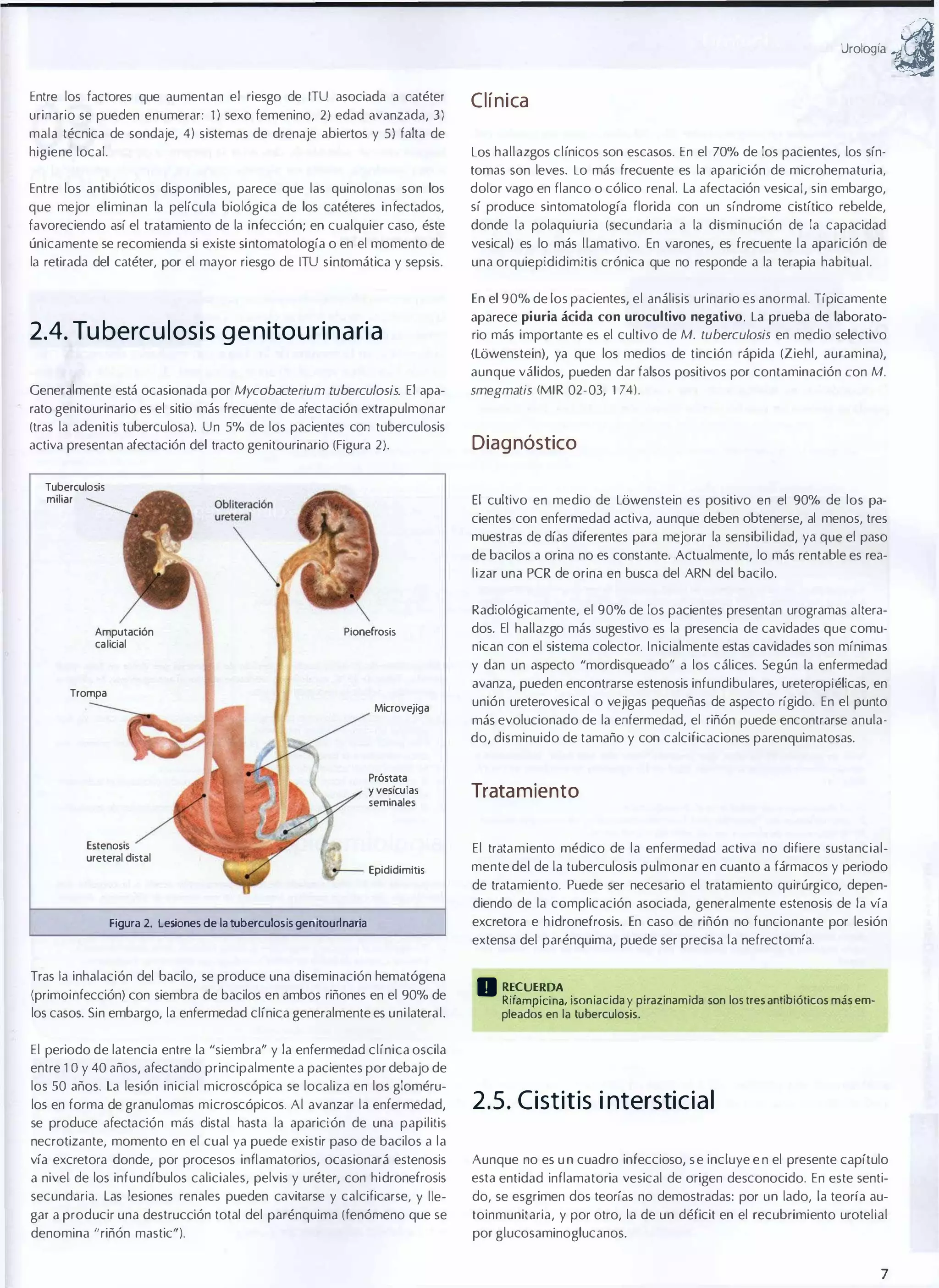 urologia

Entre los factores que aumentan el riesgo de ITU asociada a catéter
urinario se pueden enumerar: 1) sexo femenino, 2) edad avanzada, 3)

Clínica

mala técnica de sondaje, 41 sistemas de drenaje abiertos y 51 falta de
higiene local.

Los hallazgos clínicos son escasos. En el 70% de los pacientes, los sín­
tomas son leves. Lo más frecuente es la aparición de microhematuria,

Entre los antibióticos disponibles, parece que las quinolonas son los

dolor vago en flanco o cólico renal. La afectación vesical, sin embargo,

que mejor eliminan la película biológica de los catéteres infectados,

sí produce sintomatología florida con un síndrome cistítico rebelde,

favoreciendo así el tratamiento de la infección; en cualquier caso, éste

donde la polaquiuria (secundaria a la disminución de la capacidad

únicamente se recomienda si existe sintomatología o en el momento de

vesical) es lo más llamativo. En varones, es frecuente la aparición de

la retirada del catéter, por el mayor riesgo de ITU sintomática y sepsis.

una orquiepididimitis crónica que no responde a la terapia habitual.

2.4. Tu berc u l os is g e n itou r i n a ri a

aparece piuria ácida con urocultivo negativo. La prueba de laborato­
rio más importante es el cultivo de M. tuberculosis en medio selectivo

En el 90% de los pacientes, el análisis urinario es anormal. Típicamente

(Lowenstein), ya que los medios de tinción rápida (Ziehl, auramina),
aunque válidos, pueden dar falsos positivos por contaminación con M.
Generalmente está ocasionada por Mycobacterium tuberculosis. El apa­

smegmatis (MtR 02-03,

174).

rato genitourinario es el sitio más frecuente de afectación extrapulmonar
(tras la adenitis tuberculosa). Un 5% de los pacientes con tuberculosis
activa presentan afectación del tracto genitourinario (Figura 2).
Tuberculosis
miliar

Diag nóstico
El cultivo en medio de Lowenstein es positivo en el 90% de los pa­
cientes con enfermedad activa, aunque deben obtenerse, al menos, tres
muestras de días diferentes para mejorar la sensibi lidad, ya que el paso
de bacilos a orina no es constante. Actualmente, lo más rentable es rea­
lizar una PCR de orina en busca del ARN del bacilo.
Radiológicamente, el 90% de los pacientes presentan urogramas altera­

Amputación
catieial

Pionefrosis

dos. El hallazgo más sugestivo es la presencia de cavidades que comu­
nican con el sistema colector. Inicialmente estas cavidades son mínimas
y dan un aspecto "mordisqueado" a los cálices. Según la enfermedad
avanza, pueden encontrarse estenosis infundibulares, ureteropiélicas, en

Trompa
Mierovejiga

Próstata

unión ureterovesical o vejigas pequeñas de aspecto rígido. En el punto
más evolucionado de la enfermedad, el riñón puede encontrarse anula­
do, disminuido de tamaño y con calcificaciones parenquimatosas.

y vesfeulas

Trata miento

Epididimitis

mente del de la tuberculosis pulmonar en cuanto a fármacos y periodo

seminales

Estenosis
ureteral distal

El tratamiento médico de la enfermedad activa no difiere sustancial­
de tratamiento. Puede ser necesario el tratamiento quirúrgico, depen­
diendo de la complicación asociada, generalmente estenosis de la vía

Figura 2. Lesiones de la tuberculosis genitourlnaria

excretora e h idronefrosis. En caso de riñón no funcionante por lesión
extensa del parénquima, puede ser precisa la nefrectomía.

Tras la inhalación del bacilo, se produce una diseminación hematógena
(primoinfección) con siembra de bacilos en ambos riñones en el 90% de
los casos. Sin embargo, la enfermedad clínica generalmente es uni lateral.

11 :�����?n�, isoniacida y pirazinamida son los tres antibióticos más em­
pleados en la tuberculosis.

El periodo de latencia entre la "siembra" y la enfermedad clínica oscila
entre 1 O Y 40 años, afectando principalmente a pacientes por debajo de
los 50 años. La lesión inicial microscópica se localiza en los gloméru­
los en forma de granulomas microscópicos. Al avanzar la enfermedad,

2.5. C istitis intersticial

se produce afectación más distal hasta la aparición de una papilitis
necrotizante, momento en el cual ya puede existir paso de bacilos a la
vía excretora donde, por procesos inflamatorios, ocasionará estenosis

Aunque no es u n cuadro infeccioso, s e incluye e n el presente capítulo

a nivel de los infundíbulos caliciales, pelvis y uréter, con hidronefrosis

esta entidad inflamatoria vesical de origen desconocido. En este senti­

secundaria. Las lesiones renales pueden cavitarse y calcificarse, y lle­

do, se esgrimen dos teorías no demostradas: por un lado, la teoría au­

gar a producir una destrucción total del parénquima (fenómeno que se

toinmunitaria, y por otro, la de un déficit en el recubrimiento urotelial

denomina "riñón mastic" ).

por glucosaminoglucanos.

7

a

 