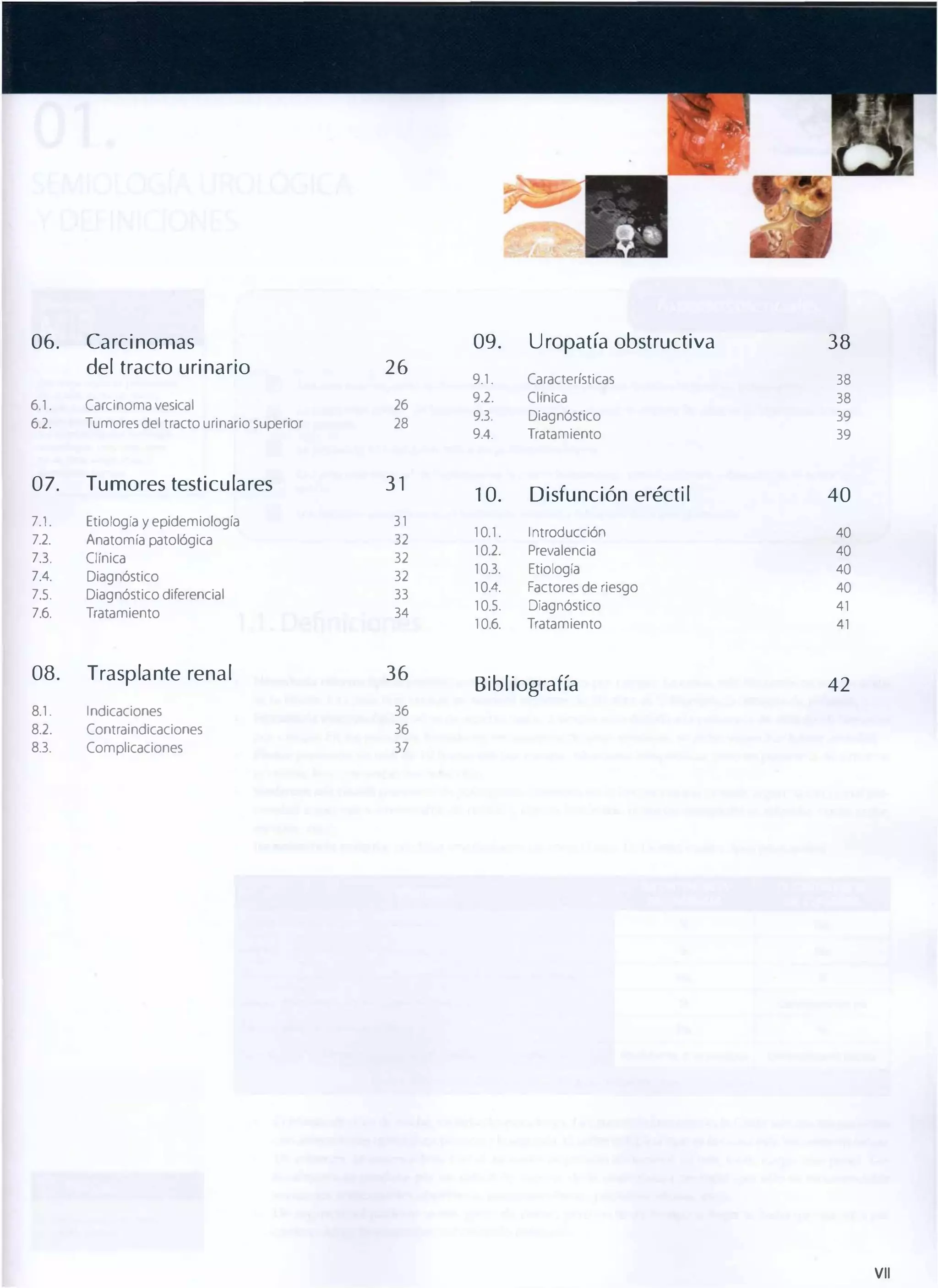 06.

09.

Carcinomas
del tracto urinario

26

6.l.

Carcinoma vesical

26

6.2.

Tumores del tracto urinario superior

28

07.

Tumores testiculares

31

7.1.

Etiología y epidemiología

31

7.2.

Anatomía patológica

32

7.3.

Clínica

32

7.4.

Diagnóstico

32

7.5-

Diagnóstico diferencial

33

7.6.

Tratamiento

34

08.

Trasplante renal

36

8.l.

Indicaciones
Contraindicaciones
Complicaciones

9.l.

Características

38

9.2.

Clínica

38

9.3.

Diagnóstico

39

9.4.

Tratamiento

39

1 0.

Disfunción eréctil

40

10.1.

Introducción

40

10.2.

Prevalencia

40

10.3.

Etiología

40

10.4.

Factores de riesgo

40

10.5-

Diagnóstico

41

10.6.

Tratamiento

41

Bibl iografía

42

36

8.3.

38

36

8.2.

Uropatía obstructiva

37

VII

 