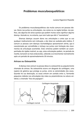 Manual do Cuidador da Pessoa Idosa | 209
Problemas musculoesqueléticos
Luciana Paganinni Piazzolla
Os problemas musculoesqueléticos são muito comuns em pessoas ido-
sas. Dores nas juntas ou articulações, nas costas ou na região lombar, nos joe-
lhos, são algumas de várias queixas que podem muitas vezes significar alguma
doença. Assinale-se, no entanto, que nem tudo que dói é “reumatismo”.
Diversas doenças causam dores nas articulações e antes que se use
qualquer medicamento sem indicação, a dor deve ser avaliada pelo médico. É
comum as pessoas com doenças reumatológicas apresentarem artrite, que é
caracterizada por vermelhidão e inchaço nas juntas com limitação dos movi-
mentos da articulação acometida. Estes sintomas podem também ser acom-
panhados de rigidez matinal, ou seja, estas articulações podem, no período da
manhã, tornarem-se mais endurecidas, voltando a se movimentar normalmente
após um período de aproximadamente 30 minutos.
Artrose ou Osteoartrite
A doença mais comum na pessoa idosa é a osteoartrite ou popularmente
chamada de artrose. Na osteoartrite ocorre um desgaste da cartilagem, uma
espécie de gelatina que protege as juntas, entre as extremidades dos ossos.
Quando há sua destruição, os ossos entram em contato entre si, formando
pequenos nódulos nas articulações das mãos ou proeminências na coluna ver-
tebral, o chamado “bico de papagaio”.
 