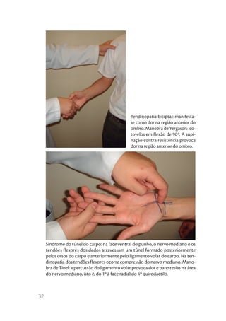 Tendinopatia biciptal: manifesta-
                                                 se como dor na região anterior do
                                                 ombro. Manobra de Yergason: co-
                                                 tovelos em flexão de 90º. A supi-
                                                 nação contra resistência provoca
                                                 dor na região anterior do ombro.




     Síndrome do túnel do carpo: na face ventral do punho, o nervo mediano e os
     tendões flexores dos dedos atravessam um túnel formado posteriormente
     pelos ossos do carpo e anteriormente pelo ligamento volar do carpo. Na ten-
     dinopatia dos tendões flexores ocorre compressão do nervo mediano. Mano-
     bra de Tinel: a percussão do ligamento volar provoca dor e parestesias na área
     do nervo mediano, isto é, do 1º à face radial do 4º quirodáctilo.



32
 