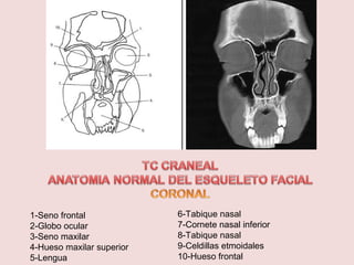 1-Seno frontal 
2-Globo ocular 
3-Seno maxilar 
4-Hueso maxilar superior 
5-Lengua 
6-Tabique nasal 
7-Cornete nasal inferior 
8-Tabique nasal 
9-Celdillas etmoidales 
10-Hueso frontal 
 