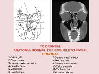 1-Crista galli 
2-Globo ocular 
3-Hueso maxilar superior 
4-Paladar duro 
5-Mandíbula 
6-Nasofaringe 
7-Cornete nasal inferior 
8-Seno maxilar 
9-Cornete nasal medio 
10-Celda etmoidal 
11-Techo orbital 
12-Lámina cribosa 
 
