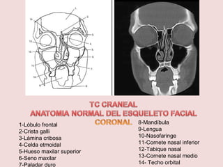 1-Lóbulo frontal 
2-Crista galli 
3-Lámina cribosa 
4-Celda etmoidal 
5-Hueso maxilar superior 
6-Seno maxilar 
7-Paladar duro 
8-Mandíbula 
9-Lengua 
10-Nasofaringe 
11-Cornete nasal inferior 
12-Tabique nasal 
13-Cornete nasal medio 
14- Techo orbital 
 