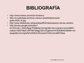 BIBLIOGRAFÍA 
• http://www.imaios.com/es/e-Anatomy 
• http://w-radiologia.es/sinus-veineux-axial/fullsize/axial-gado. 
cmunozb@unmsm.edu.pe 
0020_fs.jpg 
• http://www.slideshare.net/guestbeeff0d/interpretacion-de-tac-cerebro 
• http://books.google.es/books? 
id=XXnveLt_whAC&pg=PA4&dq=tomografia+de+craneo+coronal&hl= 
es&sa=X&ei=l8pCVMTNKYjNggTj5ILACg&ved=0CE8Q6AEwBw#v=on 
epage&q=tomografia%20de%20craneo%20coronal&f=false 
