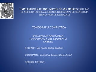 UNIVERSIDAD NACIONAL MAYOR DE SAN MARCOS FACULTAD 
DE MEDICINA ESCUELA ACADEMICA PROFESIONAL DE TECNOLOGIA 
MEDICA AREA DE RADIOLOGIA 
TOMOGRAFIA COMPUTADA 
EVALUACIÓN ANATÓMICA 
TOMOGRÁFICA DEL SEGMENTO 
CABEZA 
DOCENTE: Mg. Cecilia Muñoz Barabino 
ESTUDIANTE: Santibáñez Baldeon Diego Arnold 
CODIGO: 11010543 
 