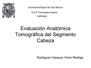 Universidad Mayor De San Marcos 
E.A.P Tecnología medica 
radiología 
Evaluación Anatómica 
Tomográfica del Segmento 
Cabeza 
Rodriguez Vasquez Victor Rodrigo 
 