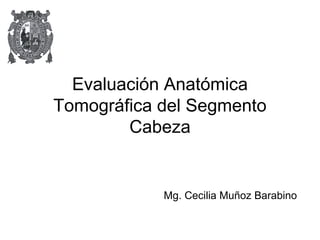 Evaluación Anatómica 
Tomográfica del Segmento 
Cabeza 
Mg. Cecilia Muñoz Barabino 
 