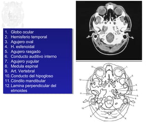1. Globo ocular 
2. Hemisferio temporal 
3. Agujero oval 
4. H. esfenoidal 
5. Agujero rasgado 
6. Conducto auditivo interno 
7. Agujero yugular 
8. Medula espinal 
9. Art. Vertebral 
10.Conducto del hipogloso 
11.Cóndilo mandibular 
12.Lamina perpendicular del 
1. Globo ocular 
2. Hemisferio temporal 
3. Agujero oval 
4. H. esfenoidal 
5. Agujero rasgado 
6. Conducto auditivo interno 
7. Agujero yugular 
8. Medula espinal 
9. Art. Vertebral 
10.Conducto del hipogloso 
11.Cóndilo mandibular 
12.Lamina perpendicular del 
etmoides 
etmoides 
 