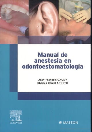 Manual de anestesia en odontoestamatología