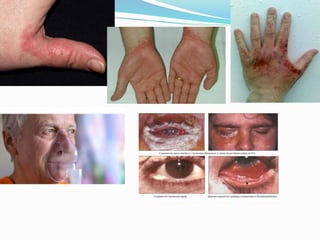 Manual  de bioseguridad fgmc