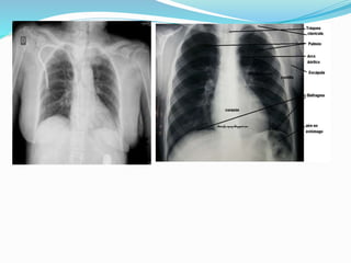 Manual  de bioseguridad fgmc