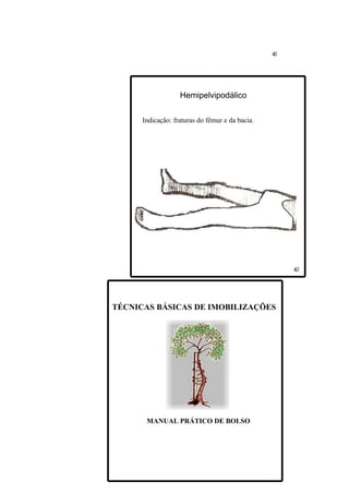 Hemipelvipodálico

      Indicação: fraturas do fêmur e da bacia.




TÉCNICAS BÁSICAS DE IMOBILIZAÇÕES




       MANUAL PRÁTICO DE BOLSO
 