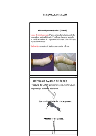FABIANO J. S. MACHADO




         Imobilização compressiva ( Jones )

Modo de confeccionar; 1º colocar malha tubular em toda
extensão a ser imobilizada, 2º coloque bastante algodão
3º enrole a atadura de crepom de modo que a imobilização
fique compressiva.

Indicações; nos pós cirúrgicos, para evitar edema.




   MATERIAIS DA SALA DE GESSO
 Tesoura de Lister; para cortar gesso, malha tubular,

esparadrapo e atadura de crepom.




          Serra vibratória de cortar gesso.




                Afastador de gesso.
 