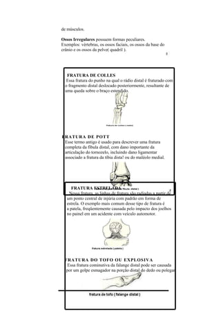 de músculos.

Ossos Irregulares possuem formas peculiares.
Exemplos: vértebras, os ossos faciais, os ossos da base do
crânio e os ossos da pelve( quadril ).




   FRATURA DE COLLES
   Essa fratura do punho na qual o rádio distal é fraturado com
  o fragmento distal deslocado posteriormente, resultante de
  uma queda sobre o braço estendido.




FRATURA DE POTT
 Esse termo antigo é usado para descrever uma fratura
 completa da fíbula distal, com dano importante da
 articulação do tornozelo, incluindo dano ligamentar
 associado a fratura da tíbia dista! ou do maléolo medial.




      FRATURA ESTRELADA
    Nessa fratura, as linhas de fratura são radiadas a partir de
   um ponto central de injúria com padrão em forma de
   estrela. O exemplo mais comum desse tipo de fratura é
   a patela, freqüentemente causada pelo impacto dos joelhos
   no painel em um acidente com veículo automotor.




 FRATURA DO TOFO OU EXPLOSIVA
   Essa fratura cominutiva da falange distal pode ser causada
  por um golpe esmagador na porção distal do dedo ou polegar.
 