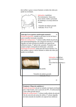 não molhar o gesso e mexer bastante os dedos das mãos pra
ajudar na circulação.

                          Indicações; imobilizar
                          Provisóriamente fratura dos
                          terços distal, médio e proximal
                          do antebraço e no terço distal do
                          úmero.

                           Tamanho da atadura gessada
                           Indicada; 10 ou 15 cm



Tala tipo Luva (goteira antebraquio manual )
Posição do paciente; sentado na da maca ou em um banco
com o membro lesionado estendido.
Modo de confeccionar; 1º colocar malha tubular da articula_
ção metacarpofalangeana até a prega do cotovelo;2º colocar
algodão em toda extensão do membro em especial nas
saliências ósseas, 3º aplicar tala gessada, 4º prender com
crepom sempre começando de distal para proximal.
Orientação do paciente; pedir para não mexer durante 2 hs,
não molhar o gesso e mexer bastante os dedos das mãos pra
ajudar na circulação.


                                            Indicações; imobilizar
                                            provisóriamente fratura
                                            do
                                            terço distal do antebraço e
                                            nas

                   tendinites do punho.


                   Tamanho da atadura gessada
                           Indicada; 10 cm




   Pendente ( Pinça de confeitero )
   Posição do paciente;em pé ou sentado com ligeira inclinação
   para o lado lesado, com o cotovelo em 90°,. O enfaixamento
   é uma calha gessada tipo U.
   Modo de confeccionar; 1º colocar malha tubular da articula
   Cão do cotovelo até acima do ombro; 2º colocar algodão
   em toda extensão do membro em especial nas saliências
 
