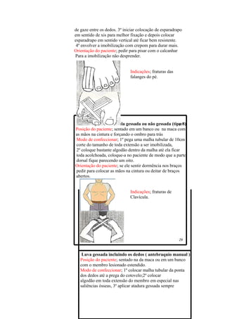 de gaze entre os dedos. 3º iniciar colocação de esparadrapo
em sentido de xis para melhor fixação e depois colocar
esparadrapo em sentido vertical até ficar bem resistente.
 4º envolver a imobilização com crepom para durar mais.
Orientação do paciente; pedir para pisar com o calcanhar
Para a imobilização não desprender.


                              Indicações; fraturas das
                              falanges do pé.




Imobilização de clavícula gessada ou não gessada (tipo 8)
Posição do paciente; sentado em um banco ou na maca com
as mãos na cintura e forçando o ombro para trás
Modo de confeccionar; 1º pega uma malha tubular de 10cm
corte do tamanho de toda extensão a ser imobilizada,
2º coloque bastante algodão dentro da malha até ela ficar
toda acolchoada, coloque-a no paciente de modo que a parte
dorsal fique parecendo um oito.
Orientação do paciente; se ele sentir dormência nos braços
pedir para colocar as mãos na cintura ou deitar de braços
abertos.


                              Indicações; fraturas de
                              Clavícula.




    Luva gessada incluindo os dedos ( antebraquio manual )
   Posição do paciente; sentado na da maca ou em um banco
   com o membro lesionado estendido.
   Modo de confeccionar; 1º colocar malha tubular da ponta
   dos dedos até a prega do cotovelo;2º colocar
   algodão em toda extensão do membro em especial nas
   saliências ósseas, 3º aplicar atadura gessada sempre
 